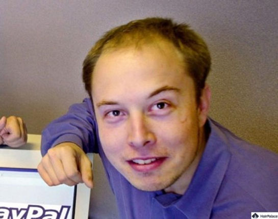 Musk Hairline